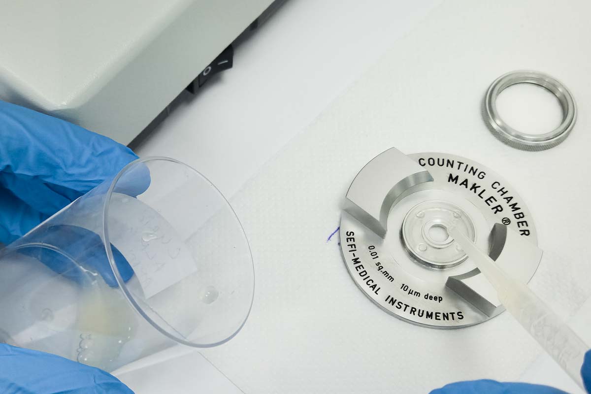 Analiza i selekcija spermatozoida u procesu vantelesne oplodnje – IVF laboratorija BB Clinic