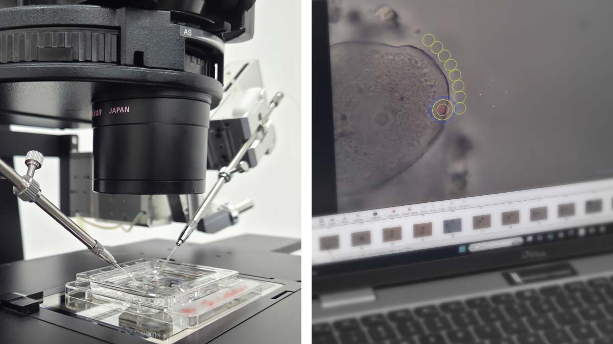 Mikromanipulacija i digitalna analiza embriona u IVF laboratoriji – B.B. Clinic Valjevo