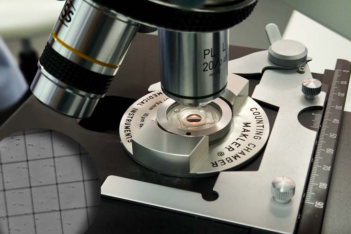 Mikroskopska analiza spermatozoida u procesu vantelesne oplodnje – IVF laboratorija B.B. Clinic